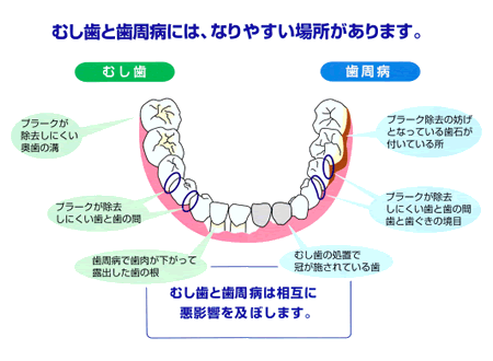 ނƎaɂȂ₷ꏊ